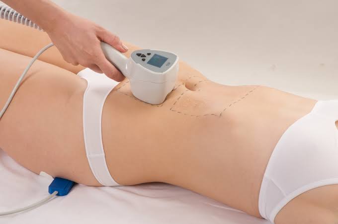 Exilis par BTL — Corps